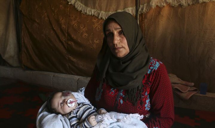 أم سورية تناشد لمساعدة طفلها قبل فقدان عينه